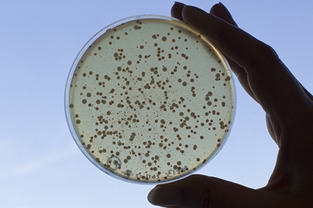 A hand holds up for display a petri dish with microorganisms.